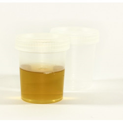 Infection urinaire Pack Homéopathie Conseil