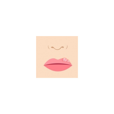 Bouton Labial Pack Conseil Homeopathique Des Les Premiers Symptomes Bouton Labial Pack Conseil Homeopathique Des Les Premiers Symptomes