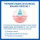 Hyalugel Forte Gel buccal