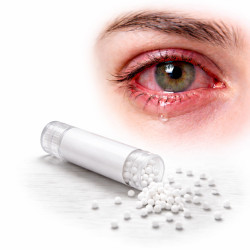 Conjonctivite Pack Homéopathie Conseil