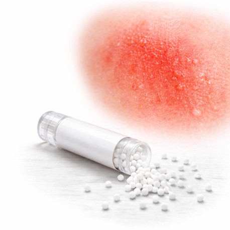 Brûlure Pack Homéopathie Conseil