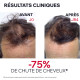 AP Hair Sérum anti-chute Uriage